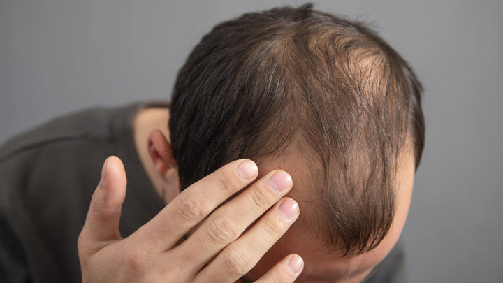 Advanced Hair Fall Analysis